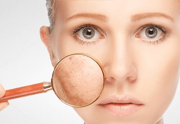 best-dermatologist-delhi