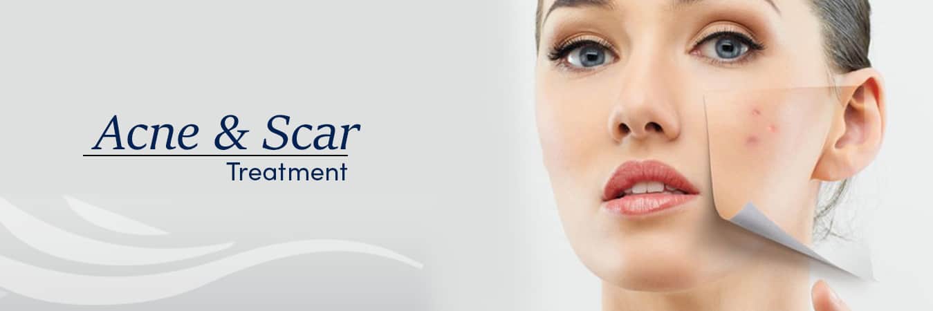 best-dermatologist-in-delhi